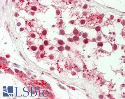 IHC-plus™ ACCN1 / ASIC2 Antibody (aa120-148)