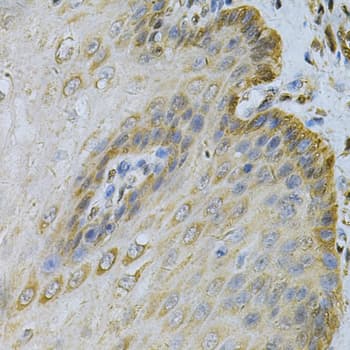 Polyclonal Rabbit anti-Human PGK1 / Phosphoglycerate Kinase Antibody (IHC, WB)