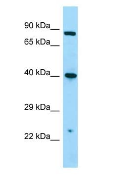 Polyclonal Rabbit anti-Human NMUR1 Antibody (C-Terminus, WB)