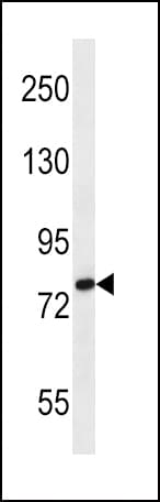 SLC9A2 / NHE2 Antibody (aa754-783)