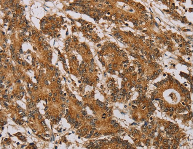 NDUFA10 Antibody