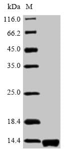 Salmonella typhimurium prgJ Protein (Recombinant 6His, N-terminus + Myc, C-terminus)