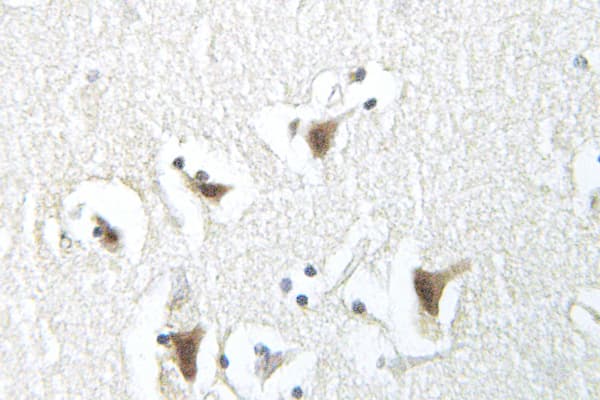 Polyclonal Rabbit anti-Human SNCA / Alpha-Synuclein Antibody (Asp119, IHC, WB)