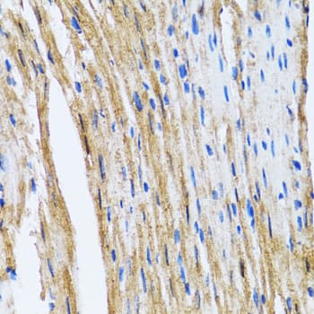 GOLM1 / GP73 / GOLPH2 Antibody