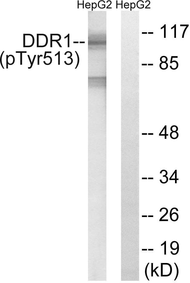 NEP / DDR1 Antibody (phospho-Tyr513)
