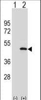Polyclonal Rabbit anti-Human ATG3 Antibody (aa83-112, WB)