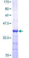 Human DCT / Dopachrome Tautomerase Protein (Recombinant GST, N-terminus)