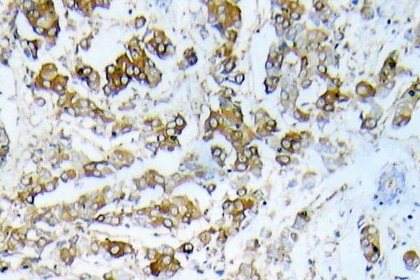 Polyclonal Rabbit anti-Human HSPB1 / HSP27 Antibody (aa35-84, IHC)