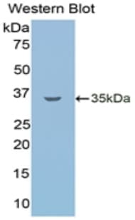 LSR / LISCH7 Antibody (aa335-589)