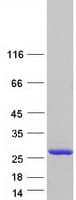 Human ADAT2 Protein (Recombinant Myc-DDK (Flag))