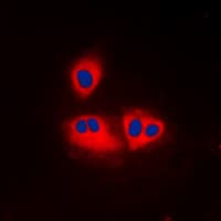 Polyclonal Rabbit anti-Human ACOT2 Antibody (Internal, IHC, IF, WB)