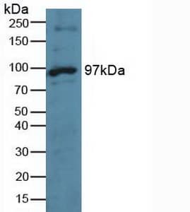 MPS1 / TTK Antibody (aa532-786)