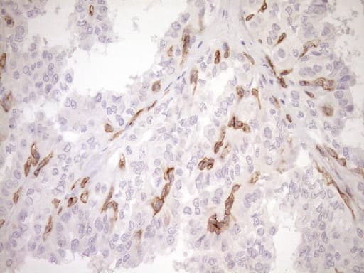 Monoclonal Mouse anti-Human BLNK Antibody (clone OTI4C9, aa1-292, IHC, WB)