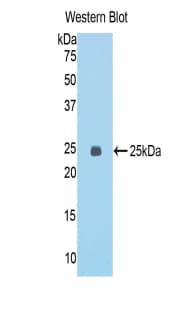 ECT2 Antibody (aa453-647)