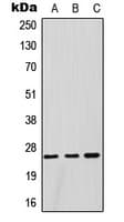 Polyclonal Rabbit anti-Human GSTM1 Antibody (Internal, WB)