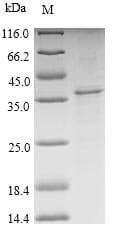 Pig TSPO / PBR Protein (Recombinant 10His-SUMO, N-terminus + Myc, C-terminus)