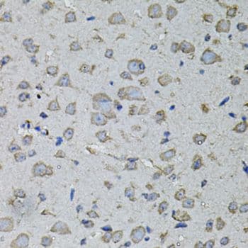IL1A / IL-1 Alpha Antibody