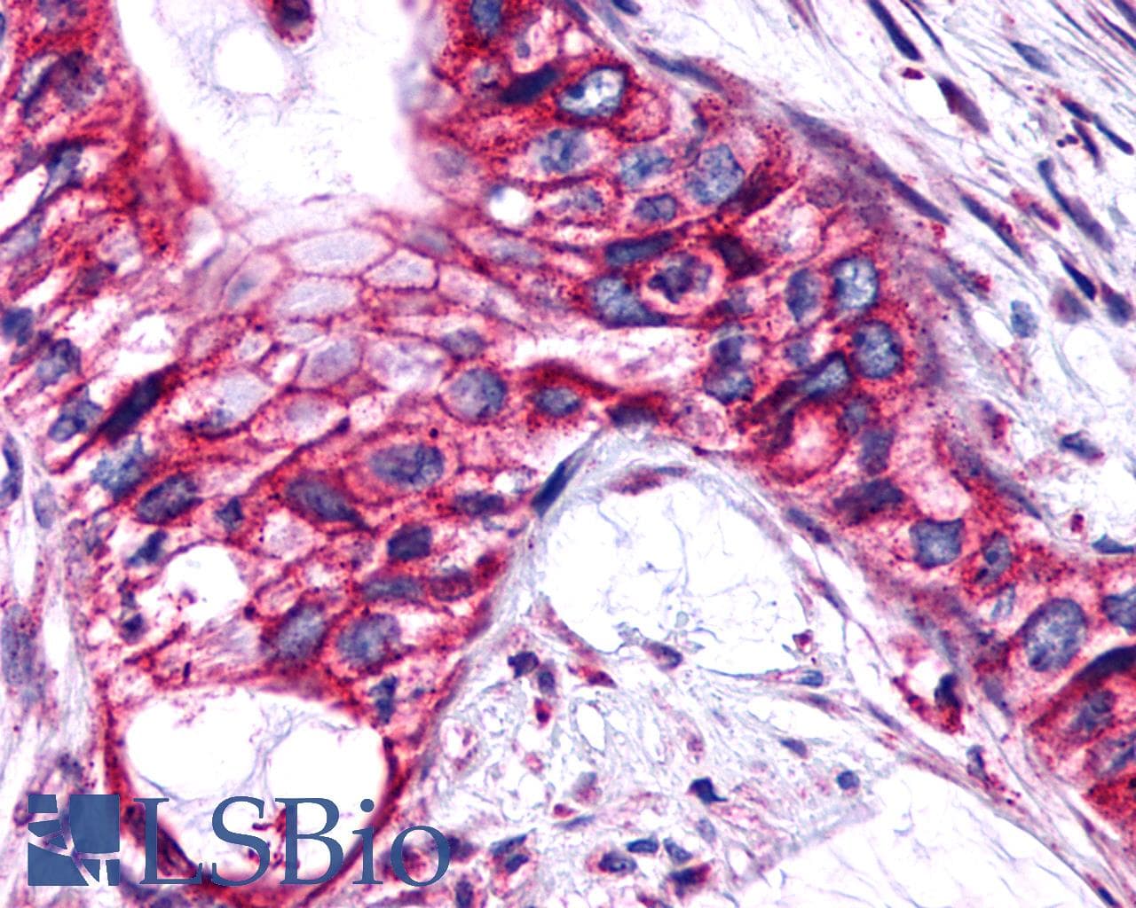PathPlus™ Polyclonal Rabbit anti-Human PTGER4 / EP4 Antibody (C-Terminus, IHC)