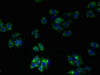 Polyclonal Rabbit anti-Human TMEM41A Antibody (IHC, WB)