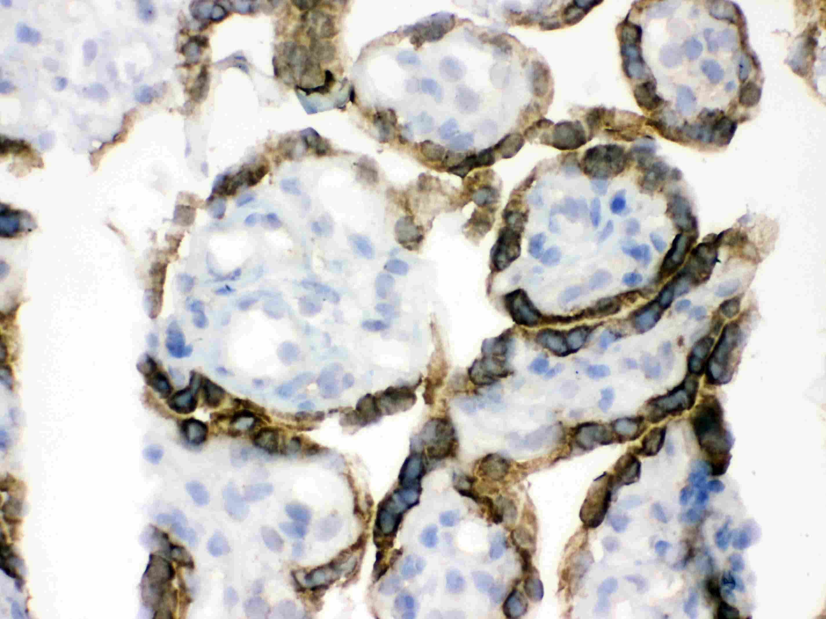 PDPK1 / PDK1 Antibody (aa524-556)