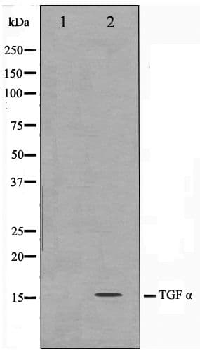 TGFA / TGF Alpha Antibody