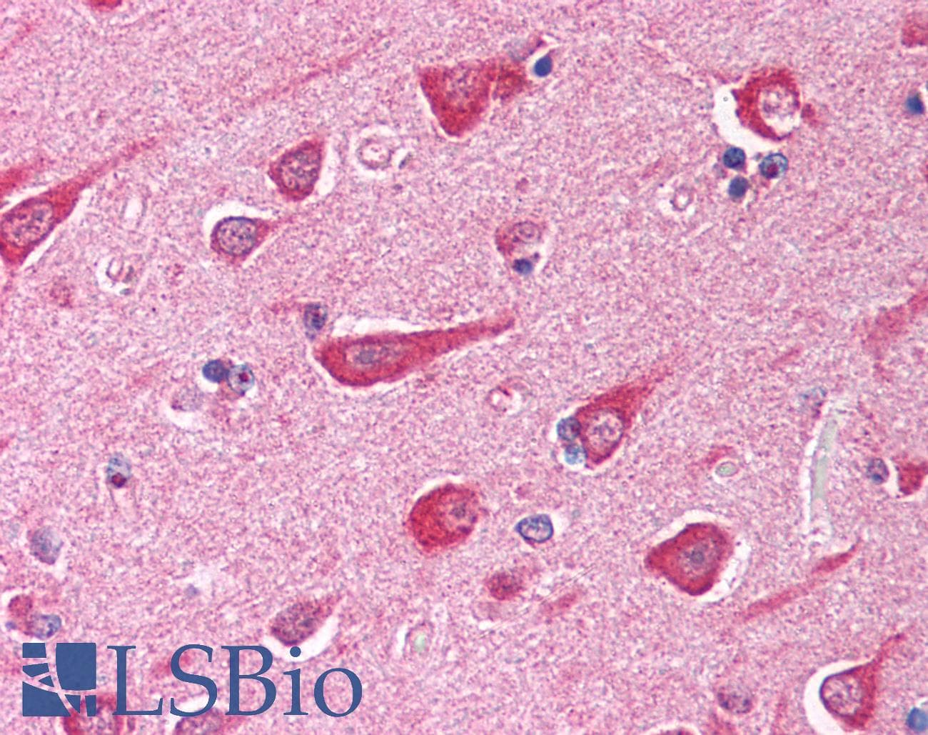 IHC-plus™ Monoclonal Mouse anti-Human Neurofibromin / NF1 Antibody (clone McNFn27, aa27-41, IHC)