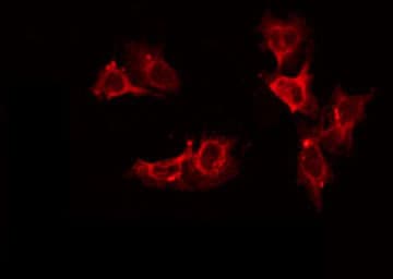 DECR2 Antibody