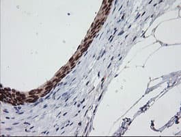 CATIP / C2orf62 Antibody (clone OTI2E6, Carrier-free)