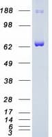 Human SYK Protein (Recombinant Myc-DDK (Flag))
