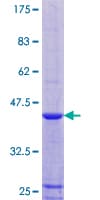 Human RPLP1 Protein (Recombinant GST)