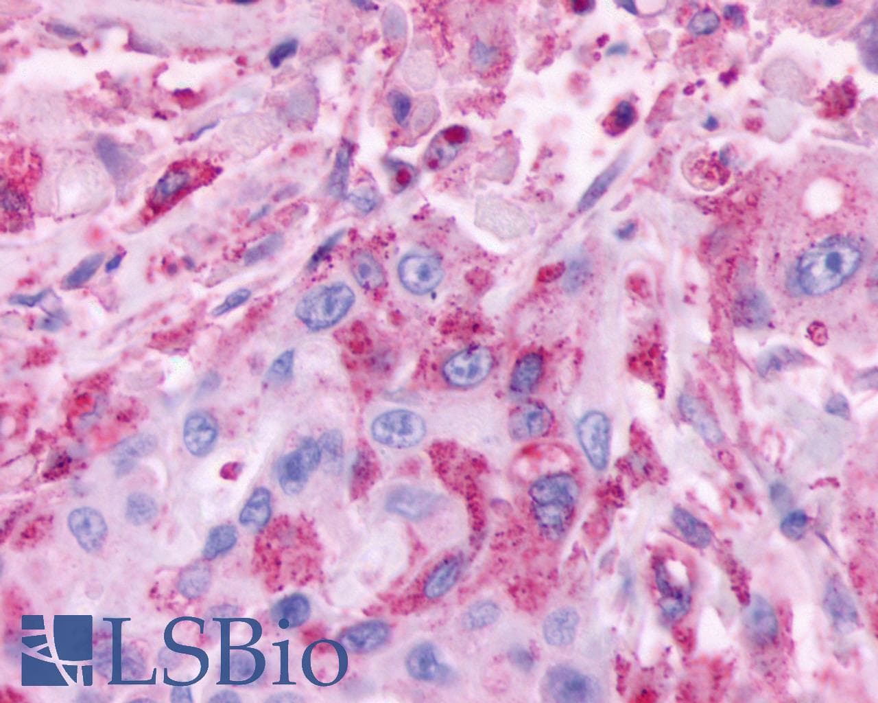 PathPlus™ CELSR2 Antibody (N-Terminus)