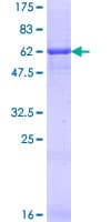 Human CFHR1 Protein (Recombinant GST)