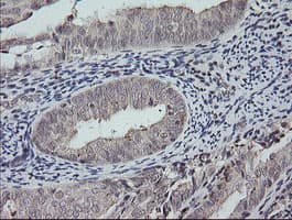 MAP2K3 / MEK3 / MKK3 Antibody (clone OTI5F9)