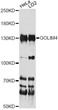 Polyclonal Rabbit anti-Human GOLIM4 / GPP130 Antibody (WB)