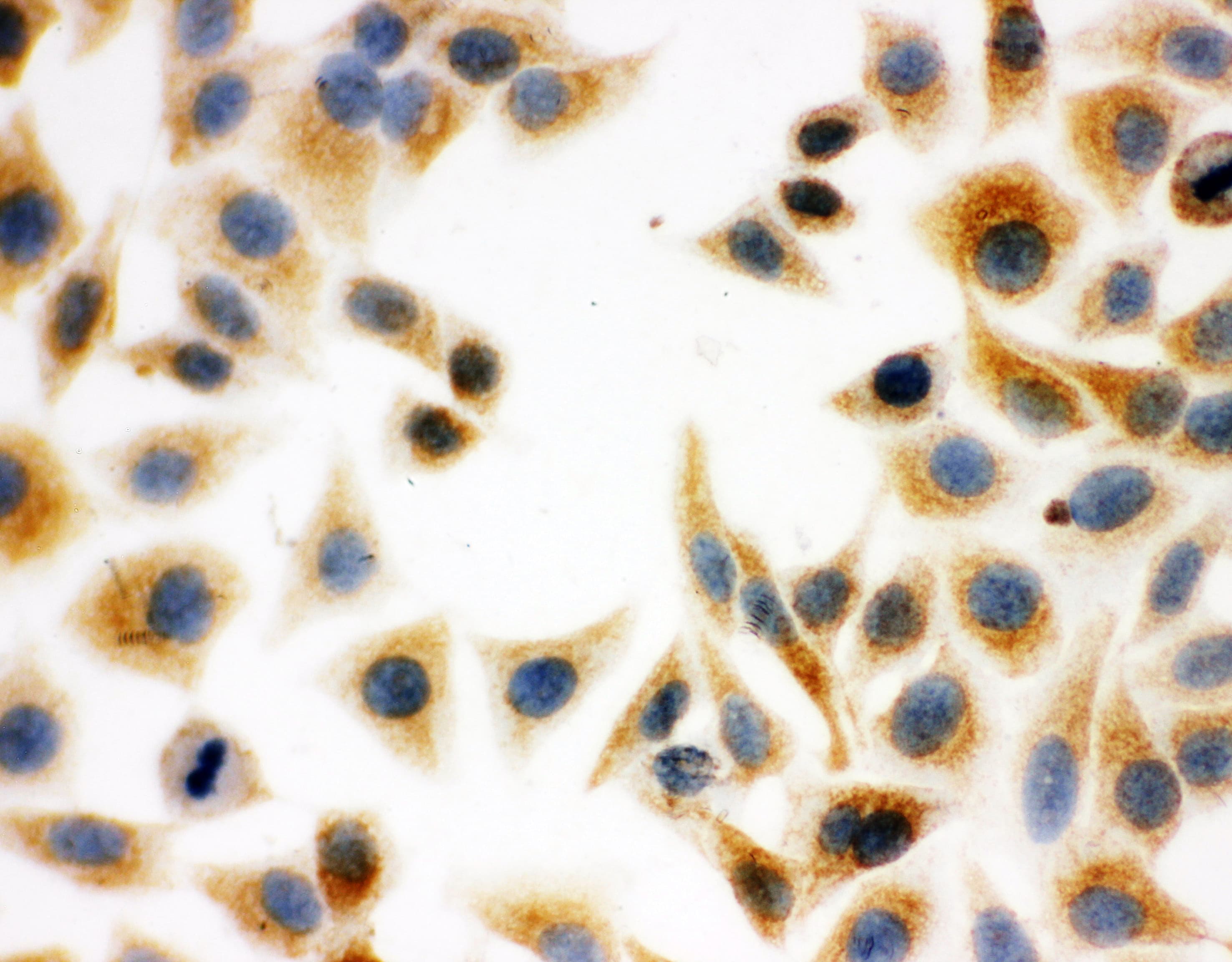 ECI1 / DCI Antibody (aa272-290)