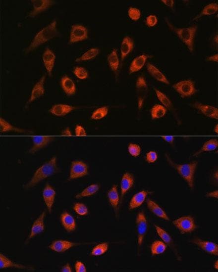 Polyclonal Rabbit anti-Human TP53I13 Antibody (IF, WB)