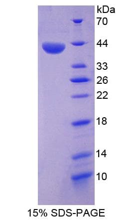 Human ANXA10 / Annexin A10 Protein (Recombinant His-S)