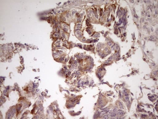 Monoclonal Mouse anti-Human ANGPTL3 Antibody (clone OTI5E6, Carrier-free, aa237-460, IHC, WB)