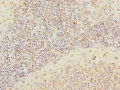 Polyclonal Rabbit anti-Human SCRG1 Antibody (IHC)