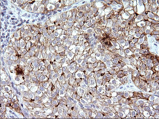 SCARB1 / SR-BI Antibody (clone OTI1G4)