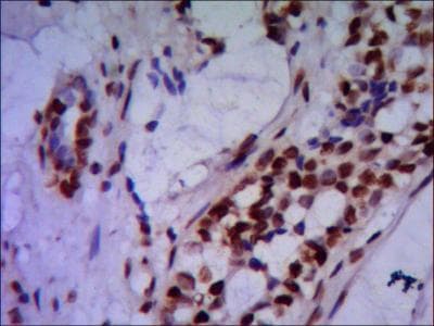 Monoclonal Mouse anti-Human PRMT6 Antibody (IHC, WB)