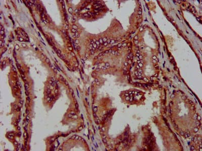 Polyclonal Rabbit anti-Human PPP2R4 Antibody (IHC, WB)