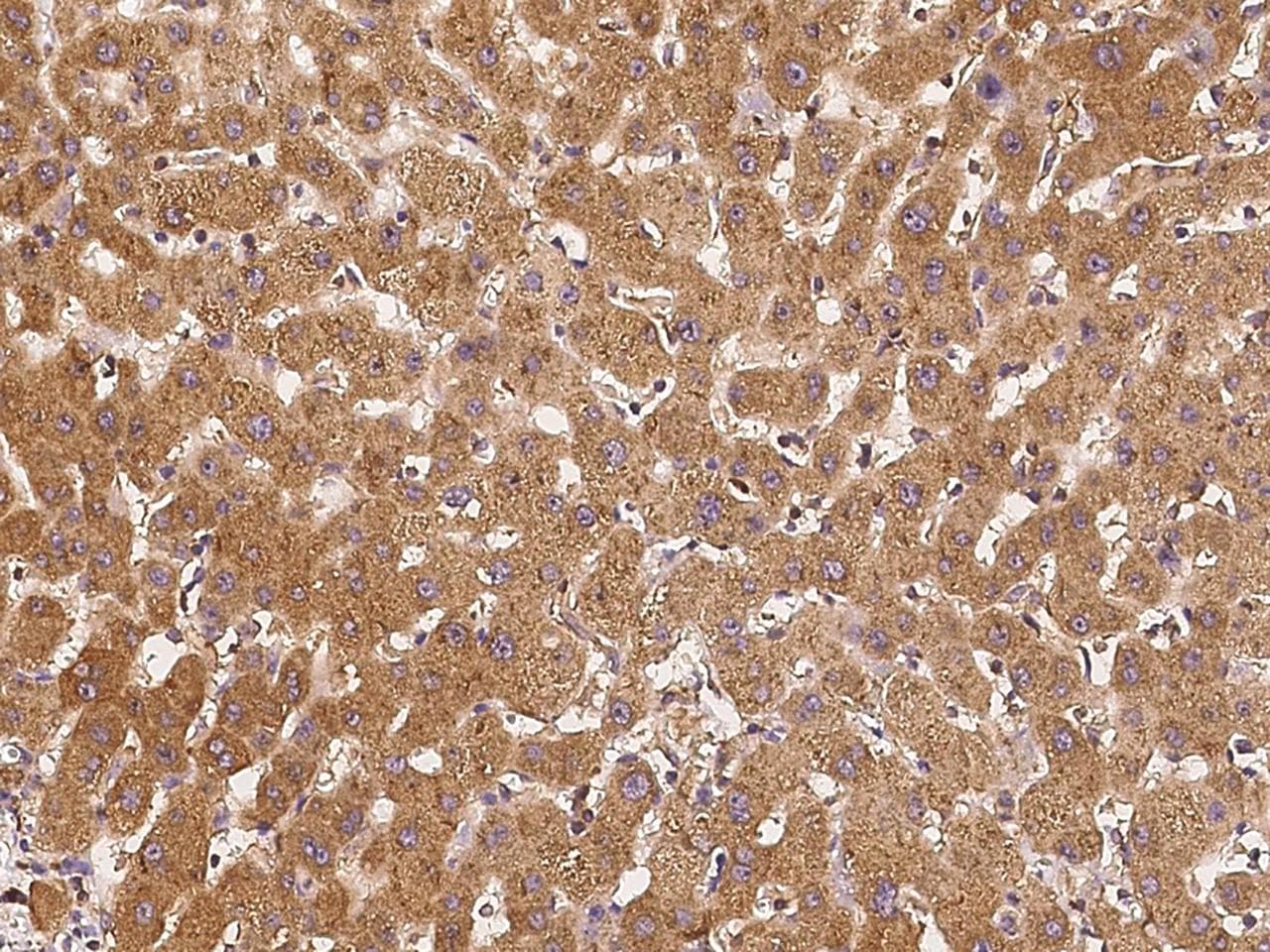 COPG / Gamma-COP Antibody