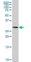 IHC-plus™ Monoclonal Mouse anti-Human AQP8 / Aquaporin 8 Antibody (clone 1F8, IHC, WB)