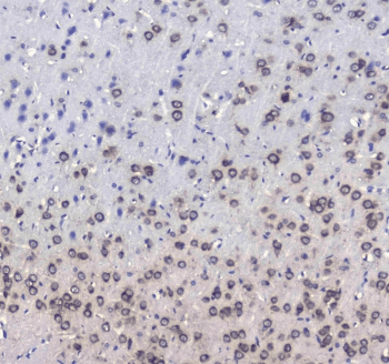 L1CAM Antibody