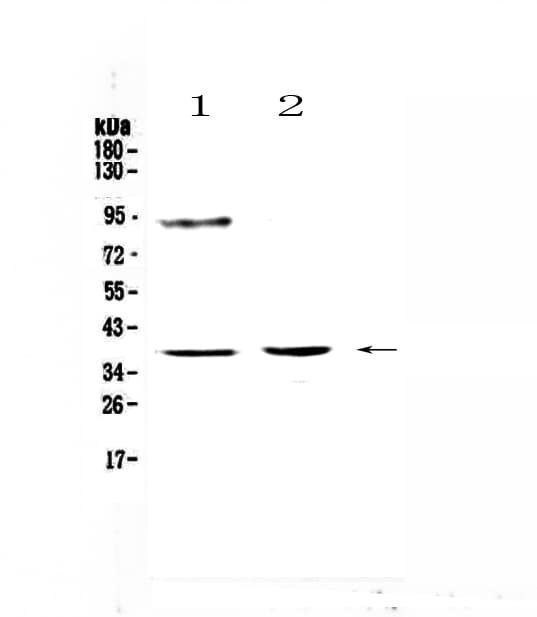 Polyclonal Rabbit anti-Mouse TBP / GTF2D Antibody (WB)