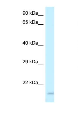 GP9 / CD42a Antibody (aa61-110)