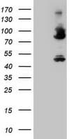 F13A1 / Factor XIIIa Antibody (clone OTI3F8)