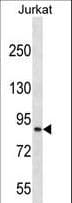 Polyclonal Rabbit anti-Human Cullin 4A / CUL4A Antibody (aa31-60, WB)