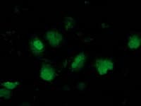 IHC-plus™ NNMT Antibody (clone 2A3)